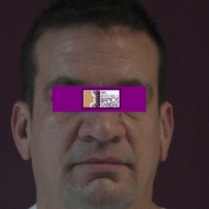 11-DESPUES