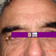 60-ANTES
