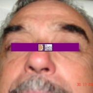 60-DESPUES